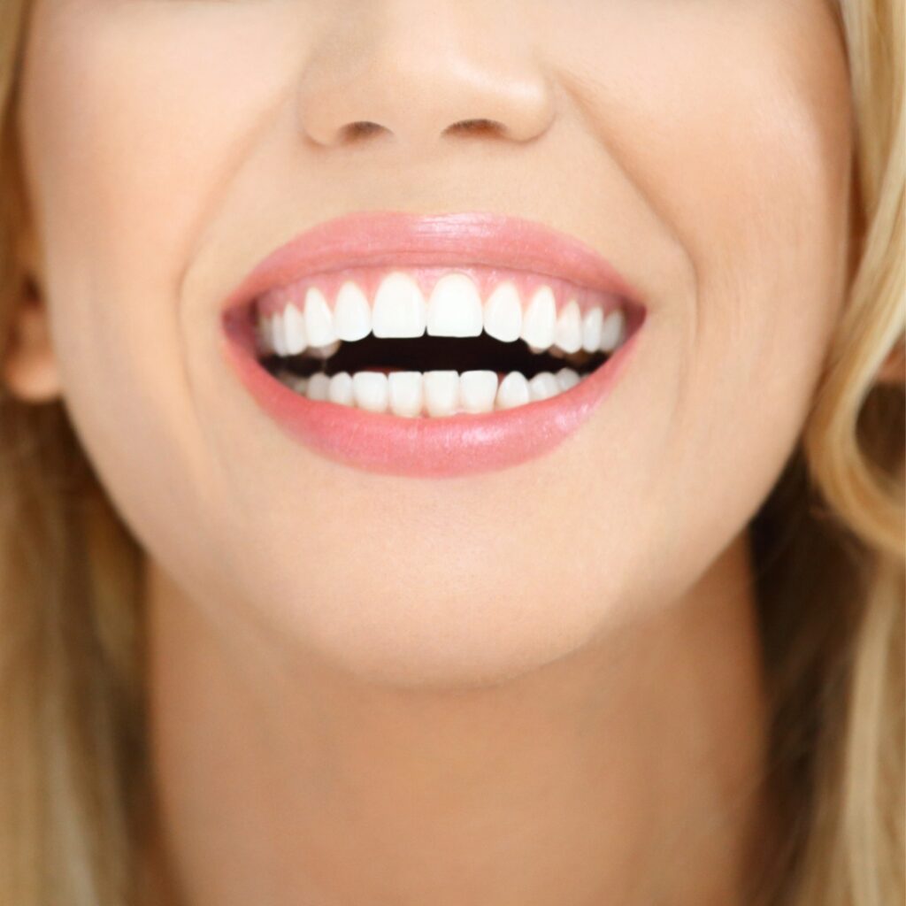 A dentist applying dental bonding to improve a patient's smile at a dental practice.