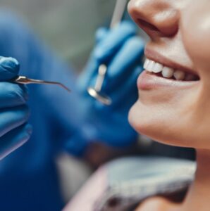 Dentist filling a cavity as part of a dental restoration procedure.