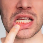 How to Prevent Gum Disease: Expert Tips for Healthy Gums